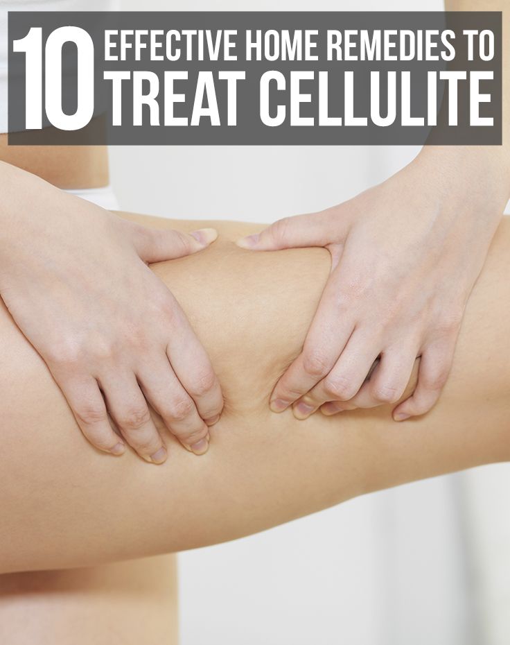 10 Effective Home Remedies To Treat cellullite