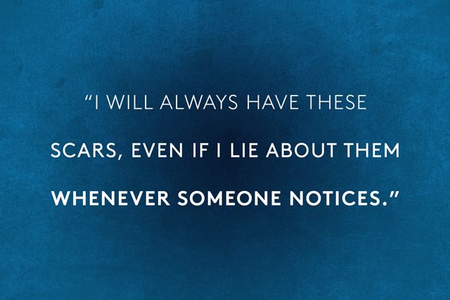 Some people ask me why I don't hide my scars...and my response is this "I hide the cuts but I don't hide the scars because they are there as a reminder to myself that I've felt worse pain. And I don't want to hide for my entire life..