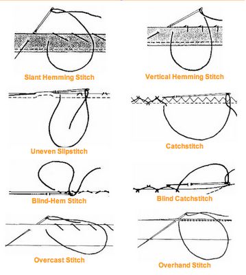 stitches