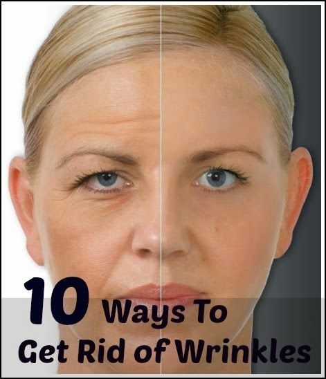 How to Get Rid of Wrinkles | Medi Tricks